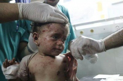 Bébé blessé par des éclats d'obus<small class="fine"> </small>? fragmentation israéliens le 18 juillet (imemc) - <span class="caps">DR</span>